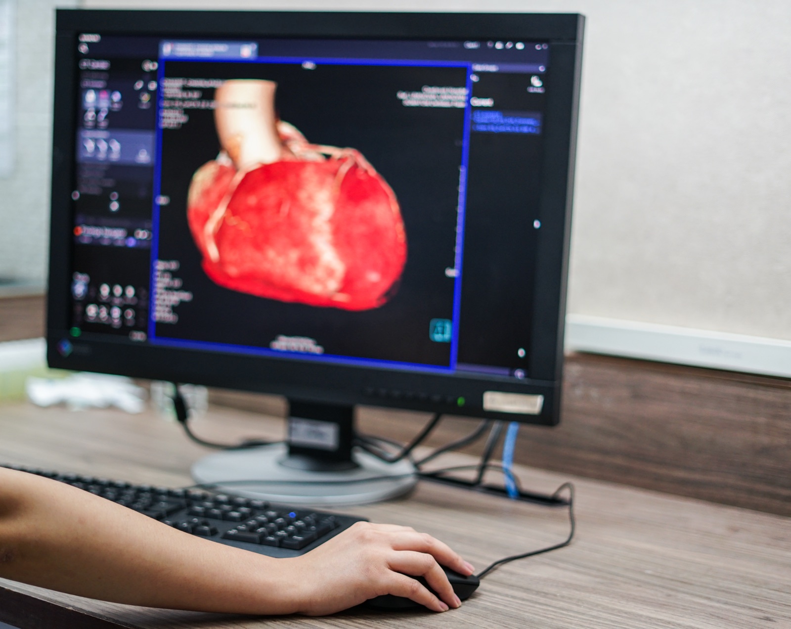 CT coronary angiography scanner