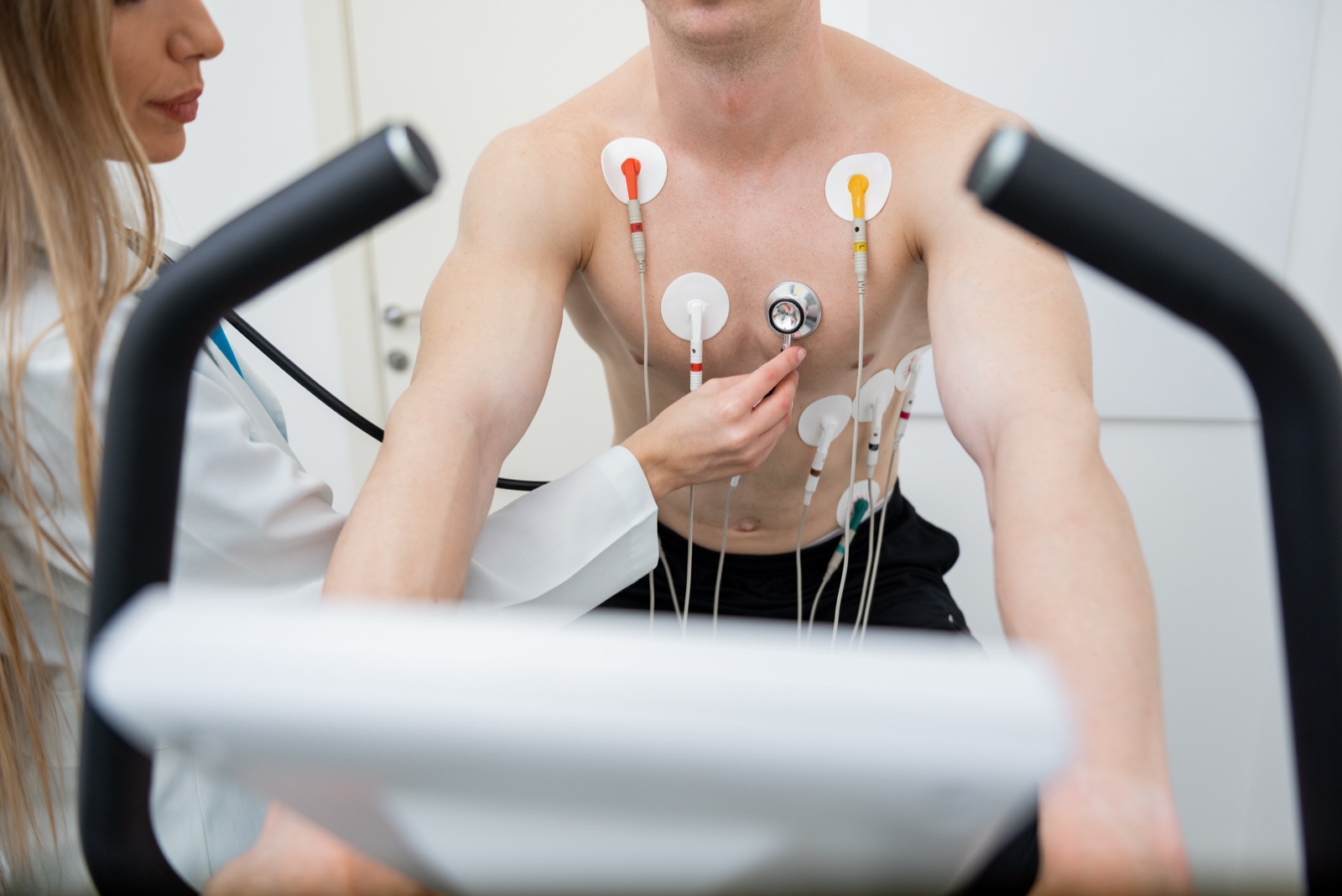 Exercise tolerance test on a treadmill