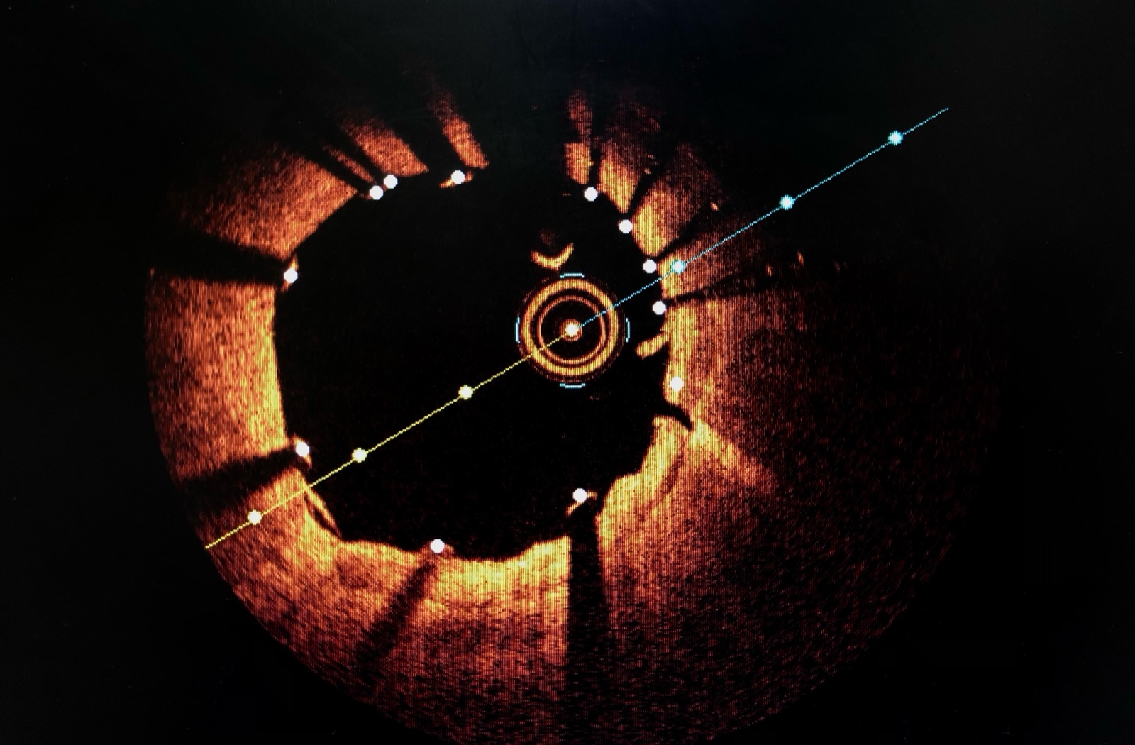 Optical coherence tomography image